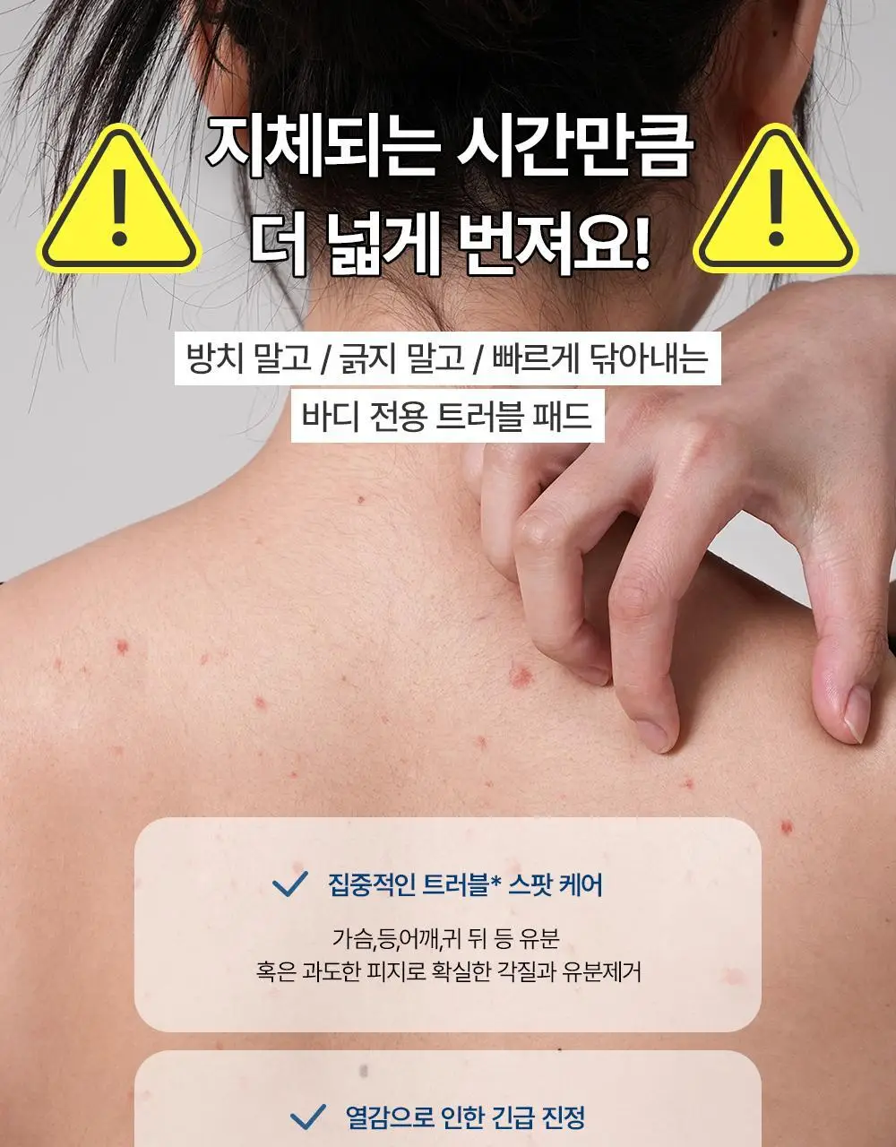 [등드름/가드름] 낫포유 클리어 SOS 바디패드 10매입 상세페이지 17